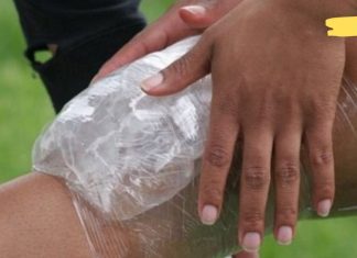 დისლოკაცია ერთ-ერთი ყველაზე გავრცელებული დაზიანებაა. გაუწიეთ სასწრაფო დახმარება ყველა წესის დაცვით!