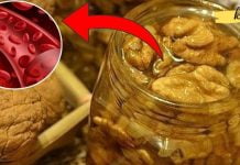 თავის ტვინის სისხლძარღვების გაწმენდის მეთოდები. ამაზე ექიმები არ საუბრობენ!