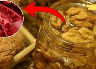 თავის ტვინის სისხლძარღვების გაწმენდის მეთოდები. ამაზე ექიმები არ საუბრობენ!