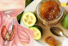 ფეიხოასა და თაფლის ნარევი მკურნალობს ფარისებრ ჯირკვალს! ეს აქამდე უნდა მცოდნოდა