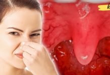 აი როგორ უნდა მოიშოროთ პირში უსიამოვნო სუნი ერთხელ და სამუდამოდ! ეს ამართლებს