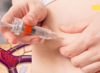 რეკომენდაციები სისხლის გასათხელებლად სახლის პირობებში. აი რა უნდა მიიღოთ და რას უნდა ერიდოთ ასეთ დროს!