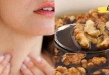 გთავაზობთ ფარისებრი ჯირკვალის სამკურნალო ხალხურ რეცეპტს, რომლის შესახებაც ექიმები არ საუბრობენ!