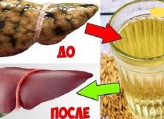 3 რეცეპტი ღვიძლის გასაწმენდად წამლების გარეშე. მე დღემდე ვემადლიერები მას!