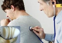 ბრონქიტის სიმპტომები და მკურნალობა! მეთოდები რომლებიც დროში გამოცდილია!