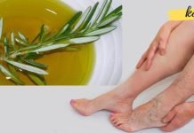 მოამზადეთ როზმარინისა და სპირტისს ნაყენი ვარიკოზული ვენების გასაქრობად. მომზადების მეთოდი იხილეთ სტატიაში!