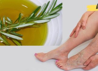 მოამზადეთ როზმარინისა და სპირტისს ნაყენი ვარიკოზული ვენების გასაქრობად. მომზადების მეთოდი იხილეთ სტატიაში!