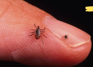 რა არ უნდა გააკეთოთ, თუ ტკიპამ დაგკბინა? აუცილებლად გასათვალისწინებელია!