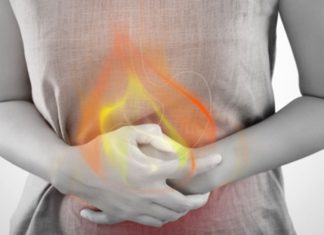 3 ბუნებრივი საშუალება გულძმარვის მოსახსნელად. ეფექტურია!