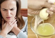 ხახვი ყელის ტკივილის საწინააღმდეგოდ! ამის შემდეგ აღარ გამოვიყენებ მედიკამენტებს, ეს ბევრად ეფექტურია!