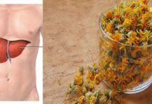 გამოიყენეთ კალენდულას ნახარში ღვიძლის დაავადების დროს!