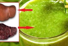 როგორ გავწმინდოთ ღვიძლი სახლის პირობებში: ბუნებრივი საშუალება.