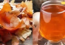 არ გადაყაროთ ხახვის კანი! მისი ნახარში ძალიან სასარგებლოა ჩვენი ჯანმრთელობისთვის! აი რა დაავადების სამკურნალოდ შეგიძლიათ გამოიყენოთ..