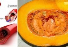 დაემშვიდობეთ ქოლესტერინს, აკონტროლეთ სისხლში გლუკოზა და ლიპიდები!