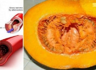 დაემშვიდობეთ ქოლესტერინს, აკონტროლეთ სისხლში გლუკოზა და ლიპიდები!