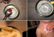 ხალხური საშუალება, რომელიც მოგიხსნით ძლიერ ხველას ერთ ღამეში! ეფექტი გასაოცარია!