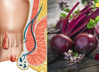 ვისაც ბუასილი აწუხებს, კარგად იცის ამ ტანჯვის შესახებ. ჩვენ გთავაზობთ უსწრაფეს მეთოდს