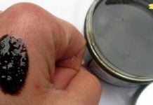 გათავისუფლდით ფსორიაზისა და ეგზემისგან ხალხური საშუალების წყალობით!