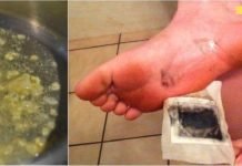 დაიდეთ ეს კომპრესი ფეხის გულებზე მთელი ღამის განმავლობაში. ეს პროცედურა დაგეხმარებათ ორგანიზმიდან ტოქსინების გამოდევნაში!