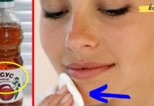 გამოიყენეთ ეს საშუალება კანის გასაახალგაზრდავებლად, ეგზემის სამკურნალოდ და აკნეს მოსაშორებლად!