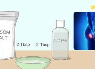 Epsom მარილი და გლიცერინი ბუასილის სამკურნალოდ. ნახეთ როგორ უნდა გამოიყენოთ ის!