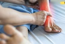 თუ ფეხების წვა გაწუხებთ, გამოიყენეთ ეს მეთოდი ამ პრობლემასთან გასამკლავებლად!