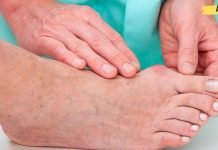 დედაჩემს წლების განმავლობაში აწუხებდა პოდაგრა. ბოლოს ხალხური რეცეპტი სცადა და შესანიშნავი შედეგი მიიღო.