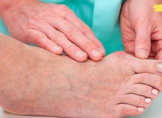 დედაჩემს წლების განმავლობაში აწუხებდა პოდაგრა. ბოლოს ხალხური რეცეპტი სცადა და შესანიშნავი შედეგი მიიღო.