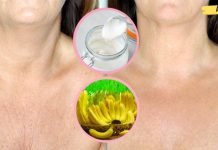 ბუნებრივი საშუალებები კისერზე და გულმკერდზე ნაოჭების შესამცირებლად.