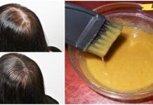 მდოგვი შაქრით სასწაულებს ახდენს! ეს თმის ნიღაბი დაგეხმარებათ თმის გასქელებასა და სწრაფ გაზრდაში!