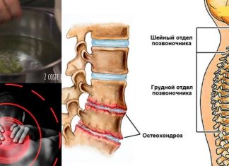 ეს რეცეპტი ძალიან ეფექტურია მარილების სამკურნალოდ. თუ ეს პრობლემა გაწუხებთ უნდა სცადოთ!