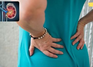 ლიმონის წვენის, ზეითუნის ზეთისა და ვაშლის ძმრის კომბინაცია შეუცვლელია თირკმლებში კენჭების დასაშლელად!