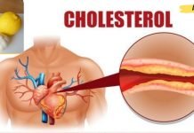 ნუ დახარჯავთ ბევრ ფულს ძვირადღირებულ წამლებში ქოლესტერინისა და წნევის დასაწევად! სცადეთ ძველი მეთოდები!