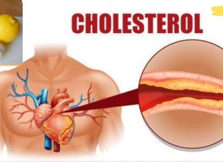 ნუ დახარჯავთ ბევრ ფულს ძვირადღირებულ წამლებში ქოლესტერინისა და წნევის დასაწევად! სცადეთ ძველი მეთოდები!