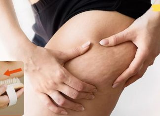 ერთი მარტივი მეთოდი ცელულიტის მოსაშორებლად და ლიმფური სისტემის გასაუმჯობესებლად!