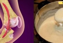 საუკეთესო ბუნებრივი საშუალება მტკივნეული სახსრებისთვის, მუხლებისა და ძვლებისთვის! მას ბევრი ადამიანი ემადლიერება!