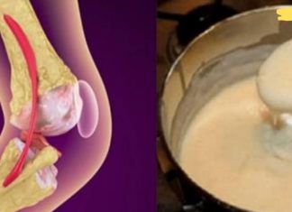 საუკეთესო ბუნებრივი საშუალება მტკივნეული სახსრებისთვის, მუხლებისა და ძვლებისთვის! მას ბევრი ადამიანი ემადლიერება!