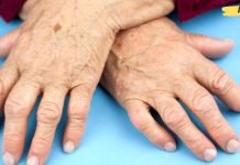 ართრიტისგან გამოწვეული ტკივილები ძალიან მტანჯავდა. რაც ეს მეთოდი აღმოვაჩინე, მას შემდეგ დავისვენე!..