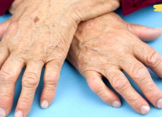 ართრიტისგან გამოწვეული ტკივილები ძალიან მტანჯავდა. რაც ეს მეთოდი აღმოვაჩინე, მას შემდეგ დავისვენე!..