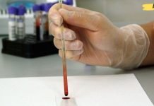 თუ ჰემოგლობინი დაგივარდათ აი რა უნდა გააკეთოთ! გასათვალისწინებელია..