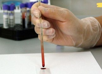 თუ ჰემოგლობინი დაგივარდათ აი რა უნდა გააკეთოთ! გასათვალისწინებელია..