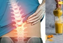 სცადეთ ეს ხელნაკეთი წამალი, რომელიც მთლიანად აღადგენს სხეულს და დაზიანებულ ხერხემალს!