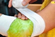 დამწვრობის, ჩირქოვანი ჭრილობების, წყლულების და ნაწოლების დროს გამოიყენეთ კომბოსტოს ფოთოლი! უებარია!