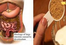 ამ გზით თქვენ შეძლებთ ორგანიზმიდან გამოდევნოთ ტოქსინები! სწრაფი და მარტივი რეცეპტები ხალხური მედიცინის წიგნაკიდან!