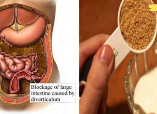 ამ გზით თქვენ შეძლებთ ორგანიზმიდან გამოდევნოთ ტოქსინები! სწრაფი და მარტივი რეცეპტები ხალხური მედიცინის წიგნაკიდან!