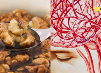 გაეცანით 5 ყველაზე ეფექტურ მეთოდს თავის ტვინის სისხლძარღვების გასაწმენდად. ის, რაც ყველას სჭირდება!