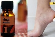 აი რატომ უნდა წაისვათ ღამით ქუსლებზე იოდი! თუ ათეროსკლეროზი ან ფარისებრი ჯირკვალის პრობლემა გაწუხებთ ეს უნდა იცოდეთ!