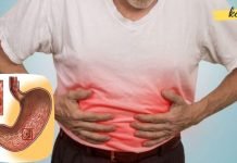 მოიცილეთ გასტრიტის სიმპტომები ბუნებრივი საშუალებებით. აი რა უნდა გააკეთოთ ამისთვის!