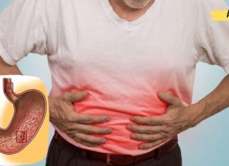 მოიცილეთ გასტრიტის სიმპტომები ბუნებრივი საშუალებებით. აი რა უნდა გააკეთოთ ამისთვის!