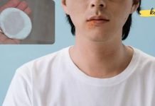 აი როგორ უნდა მოვიშოროთ ჰერპესი ხალხური საშუალებებით ერთ დღეში! ეფექტურია..